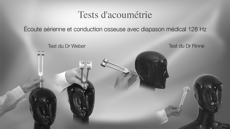 Acoumétrie du Dr Rinne et du Dr Weber